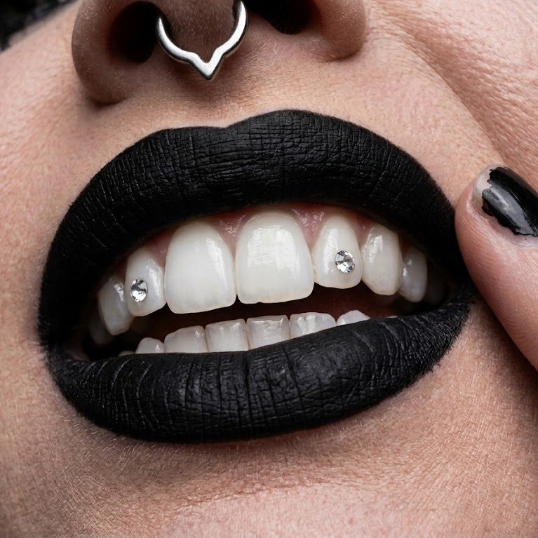 A pair of crystal tooth gems on the upper lateral incisors, with a matte black lip
