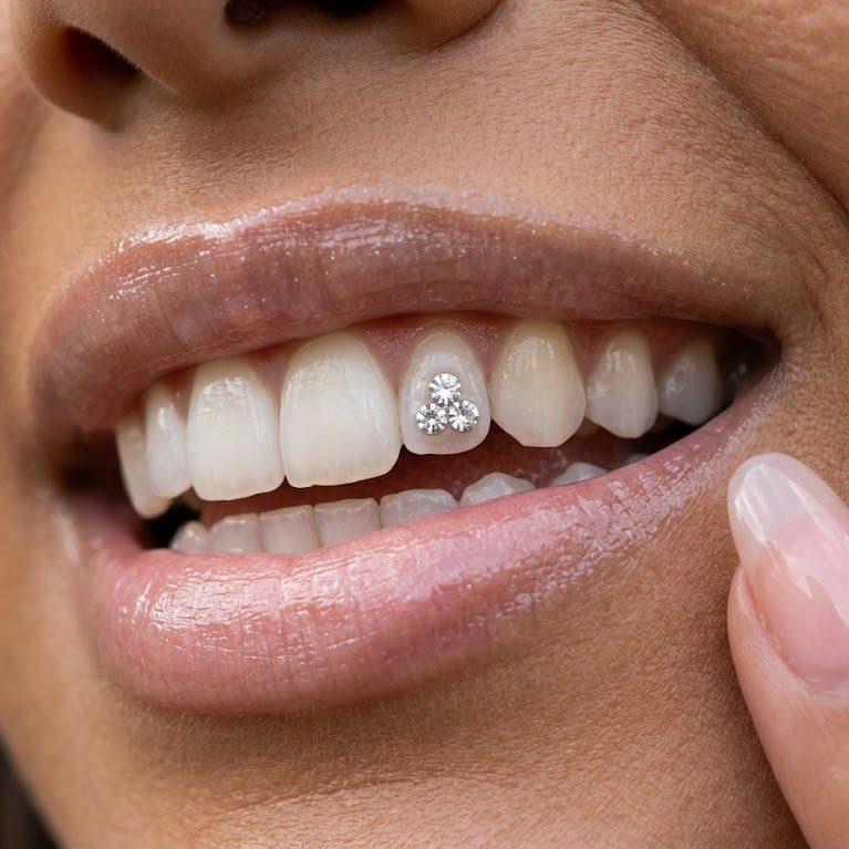 A three-stone crystal cluster tooth gem on an upper tooth